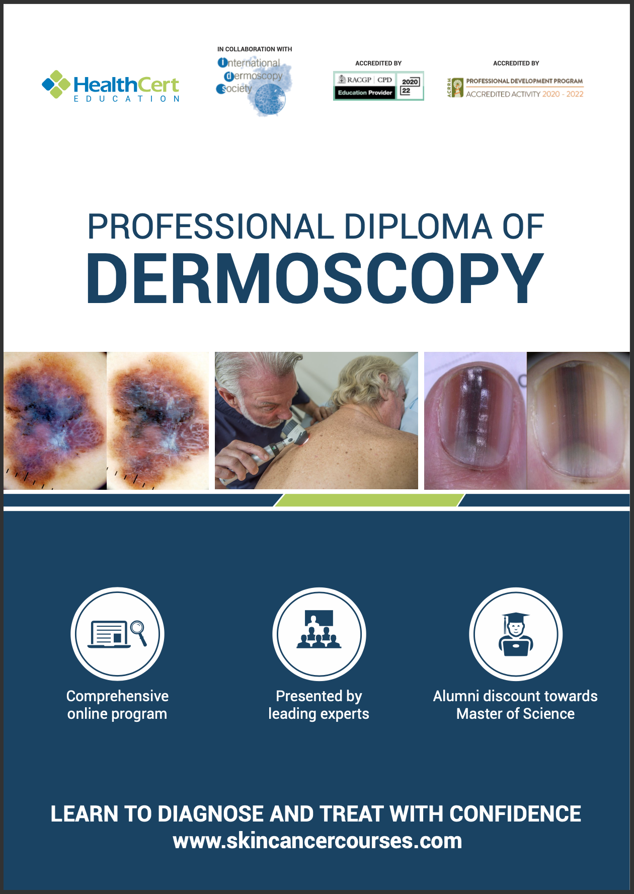 Dermoscopy